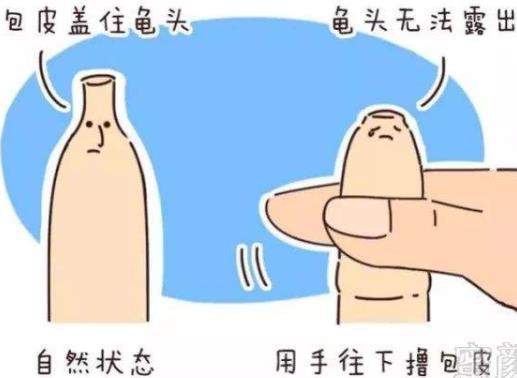 什么是包皮過長？包皮過長一定要手術(shù)割包皮嗎？