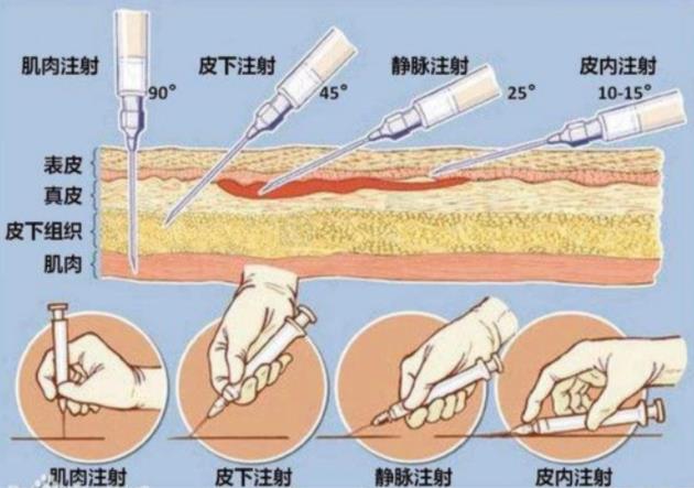 怎么接種疫苗？